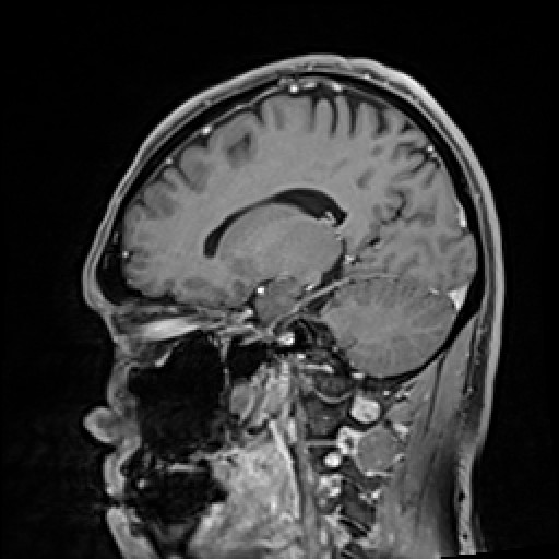 Click on the Serie image to view the images of VILLANUEVA, WILLIAM A.